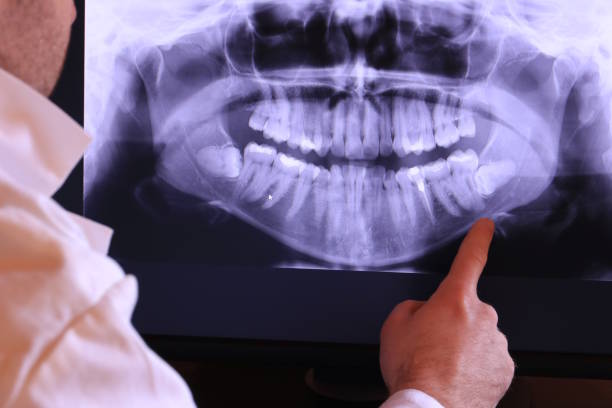 Best Emergency Wisdom Teeth Removal in Conley, GA