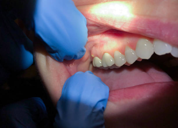 Best Emergency Tooth Extraction in Conley, GA